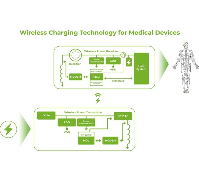 4 Ways that Wireless Charging Technology for IoMT is Revolutionizing